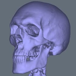 medbone