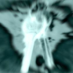 mindtrigger82