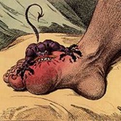 get_rid_of_gout