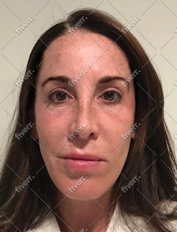 Imagem de amostra