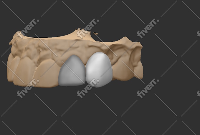 Imagen de muestra de trabajo