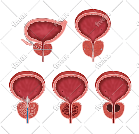 Imagen de muestra de trabajo