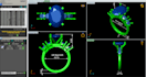 make customized jewelry cad designs, engagement rings, all types jewelry models