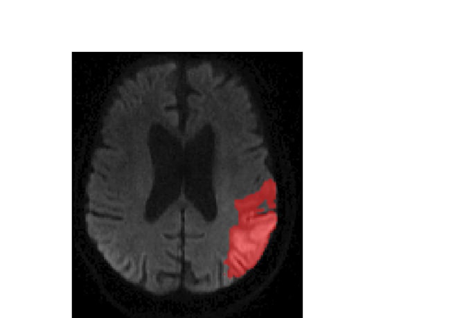 image segmentation, annotation, medical imaging