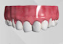 create realistic 3d medical animation, 3d dental explainer teeth procedures