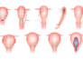 create vector medical illustration for education, healthcare and publishing