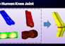 design bio implants for knee hip spine shoulder for athletes or sports injuries
