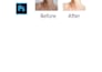 professionally remove acne and pimples from your photos