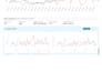 do amazon PPC management, amazon ads optimization, and acos reduction