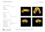 do implant planning and surgical guides