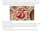 write medical blog articles for your website