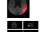 image segmentation, annotation, medical imaging