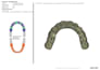 design all on x, all on 4 prosthesis using exocad