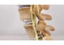 do 3d orthopedic spinal surgery animation joint replacement arthroscopy video