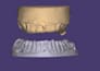 dental cad design service