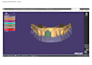 create professional dental cad designs using exocad