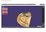 create professional dental cad designs using exocad