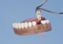 create 3d dental implants animation, dental surgery , oral procedures