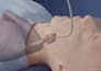do 3d cervical disc replacement spine surgery animation and medical explainer