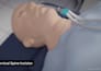 do 3d cervical disc replacement spine surgery animation and medical explainer