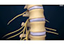 create professional 3d spine surgery orthopedic and medical animation