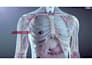create 3d medical animation for cancer immunotherapy biotech pharmaceutical