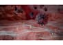 create 3d medical surgical procedure surgery explainer animation video