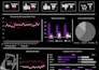 create advance excel reports, dashboards and pivottables