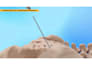 create 3d medical device and surgical implant animation