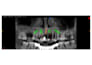 provide professional opg and cbct radiology reporting
