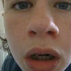 rhyscoverdale