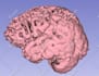 create a 3d model from your ct or mri dicoms