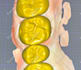 design full anatomic crowns