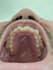 edit your teeth whiten, align and fix ,remove braces using photoshop