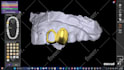 design custom tooth grills designs using exocad