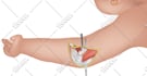 draw a medical illustration