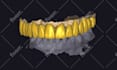 do dental prosthesis crown design using exocad, 3shape, inlab and cerec