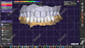 design dental design with exocad software for you