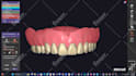 design high quality dentures using exocad