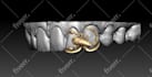do something really good at create grillz