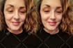 realistic nose job rhinoplasty photo simulation surgery