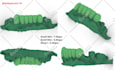 design any high end custom grillz in 3d cad