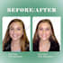 fix, whiten, and perfect your teeth smile in photoshop