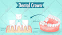 write SEO optimized medical and dental articles, and health blogs
