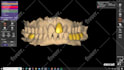 design dental design with exocad software for you