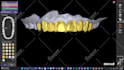design custom tooth grills designs using exocad