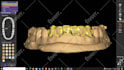 design dental design with exocad software for you