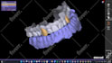 design custom tooth grills designs using exocad