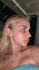 realistic nose job rhinoplasty photo simulation surgery