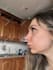 realistic nose job rhinoplasty photo simulation surgery